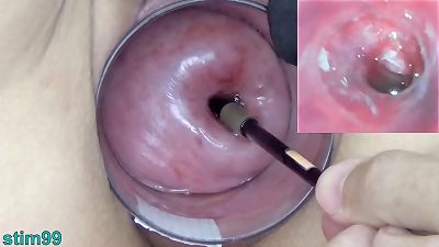 older milf Cervix play with Endoscope japanese cam into Uterus
