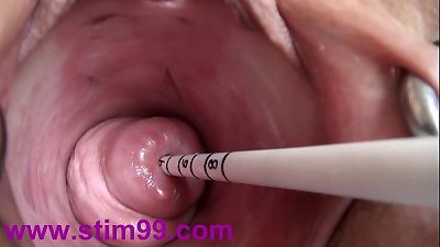 extraordinary Real Cervix pulverizing insertion chinese Sounds and Objects in Uterus